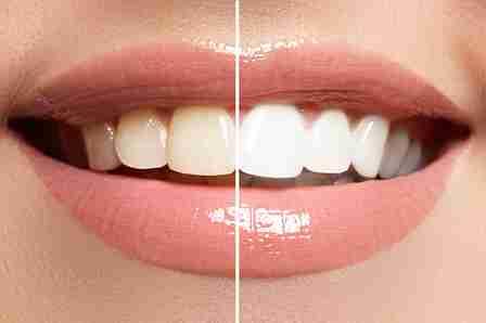 Image Source - Emergency Dentist Worthing
